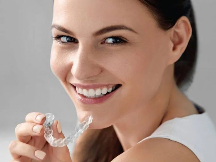 Invisalign